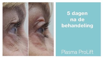 Artikel thumbnail