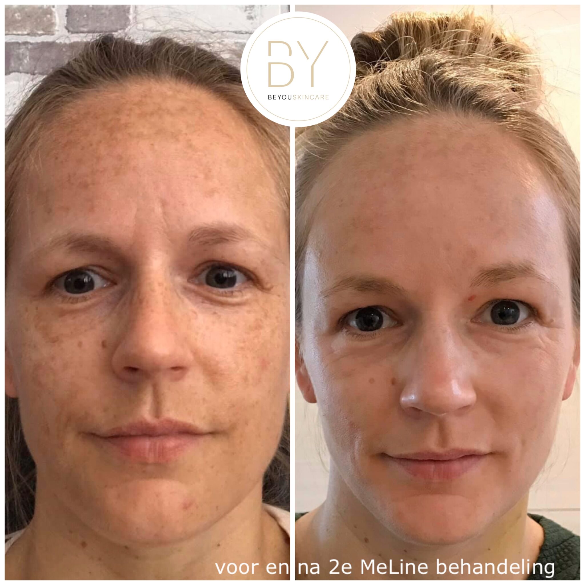 MeLine Be You Skincare